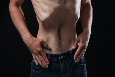 Siyah arka planda anoreksiden muzdarip bir adam, yakın plan.