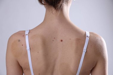 Vücudunda benler olan kadın arka planda ışığa karşı, yakın plan