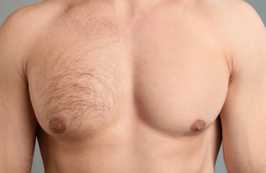 Gri arkaplandaki epilasyon işleminden önce ve sonra göğsünü gösteren adam, yakın plan.