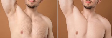 Man showing armpit and chest before and after epilation procedure on brown background, closeup. Collage of photos