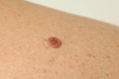 Derisinde ben olan adam arka planda, yakın plan.