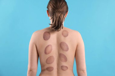 Açık mavi arka planda terapi sonrası kadın, arka plan