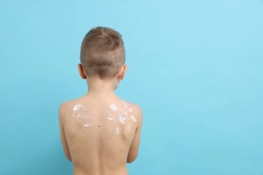 Açık mavi arka plan ve arka görüş karşısında cildinde güneş kremi olan küçük bir çocuk. Metin için boşluk