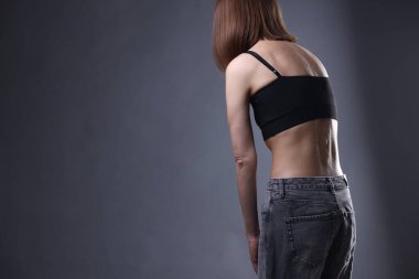 Gri arka planda iştahsızlıktan muzdarip bir kadın, yakın plan. Metin için boşluk