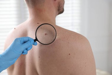 Hastanedeki adamın köstebeklerini inceleyen doktor.