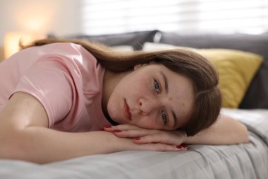 Depresyondaki genç kız evde yatakta.