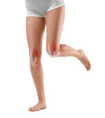 Diz anatomisi. Beyaz arka planda koşan bir kadın, yakın plan. Bacağında resim var.