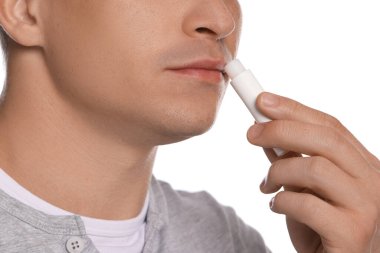 Genç adam dudaklarına merhem sürüyor, beyaz arka planda, yakın plan.