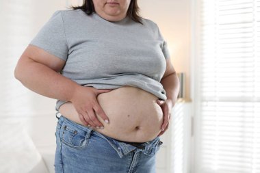 Kapalı mekanda göbeği aşırı yağlı bir kadın, yakın plan. Aşırı kilolu