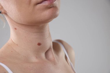 Vücudunda benler olan bir kadın, arka planda ışığa karşı, yakın plan. Metin için boşluk