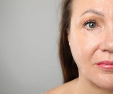 Gri arka planda estetik ameliyattan önceki kadın, yakın plan. Metin için boşluk