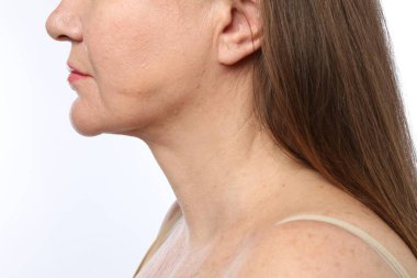 Beyaz arkaplanda kozmetik prosedüründen önce kadın, yakın plan