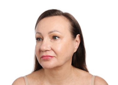 Beyaz arkaplanda kozmetik prosedüründen önce kadın