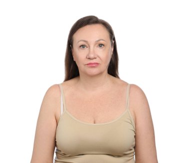 Beyaz arkaplanda kozmetik prosedüründen önce kadın