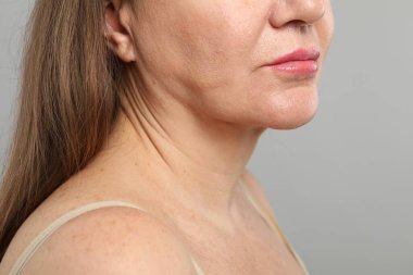 Gri arkaplanda kozmetik prosedüründen önce kadın, yakın plan