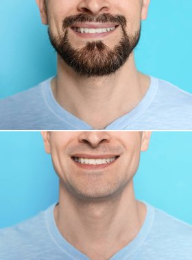 Açık mavi arka planda tıraş olmadan önce ve sonra bir adam, yakın plan. Fotoğraf Kolajı