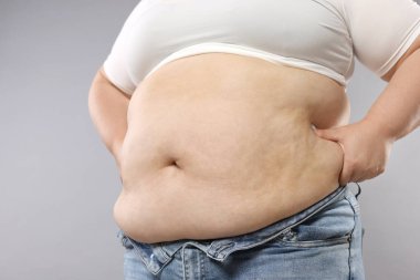 Gri arka planda aşırı göbek yağlı kadın, yakın plan. Aşırı kilolu