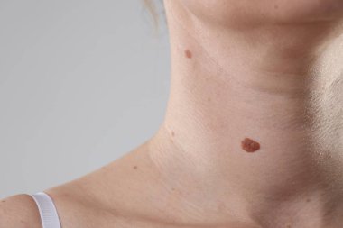 Vücudunda benler olan bir kadın, arka planda ışığa karşı, yakın plan. Metin için boşluk