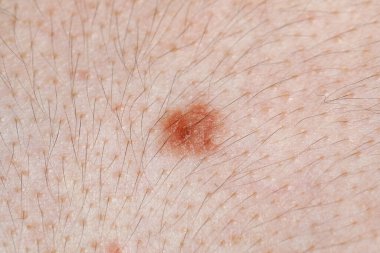 Vücudunda ben olan bir kadın, yakın plan.