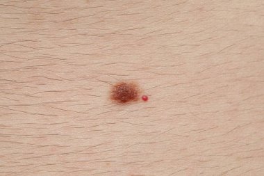 Vücudunda ben olan bir adam, yakın plan.