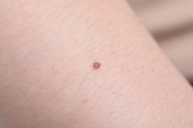 Cildinde ben olan kadın, makro manzaralı.