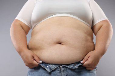 Gri arka planda aşırı göbek yağlı kadın, yakın plan. Aşırı kilolu