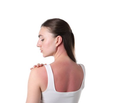 Beyaz arka planda güneş yanığı olan kadın.