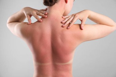 Gri arka planda güneş yanığı olan kadın.