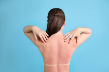 Açık mavi arka planda güneşte yanmış bir kadın.