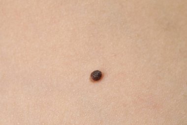 Vücudunda ben olan bir kadın, yakın plan.