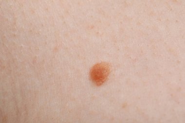 Vücudunda ben olan bir kadın, yakın plan.