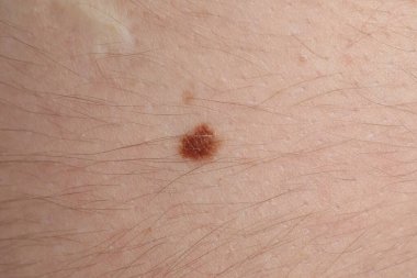 Vücudunda ben olan bir kadın, yakın plan.