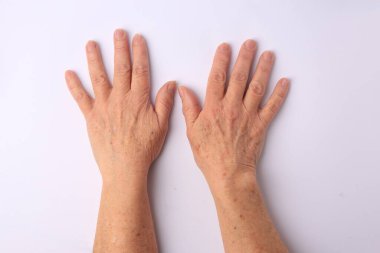 Yaşlanan tenli, üst görüşlü kadınların ellerine yakından bak.