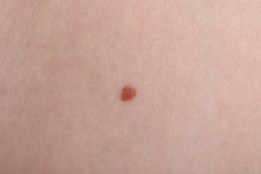 Cildinde ben olan kadın, makro manzaralı.