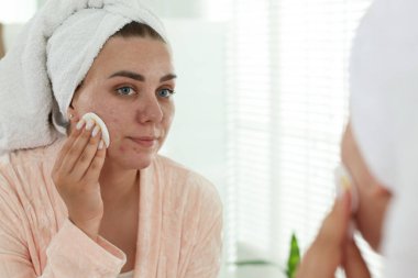 Sivilceli bir kadın aynanın içinde yüzünü temizliyor.