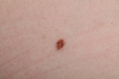 Cildinde ben olan kadın, makro manzaralı.