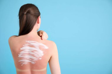 Güneş yanığı cildinde güneş koruyucu maddesi olan bir kadın açık mavi arka planda, arka planda. Metin için boşluk