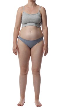 Yağ aldırma. Beyaz arka planda iç çamaşırlı kadın, yakın plan.