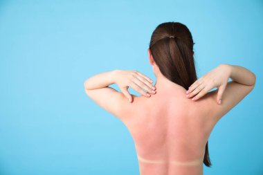 Açık mavi arka planda güneşte yanmış bir kadın. Metin için boşluk