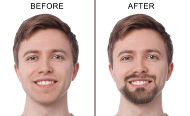 Beyaz arka planda sakallı ve tıraşlı bir adamın fotoğraflarıyla kolajdan önce ve sonra.