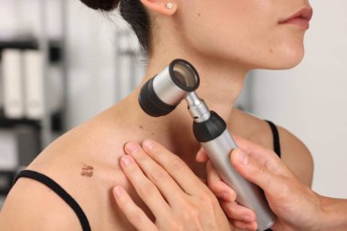 Doktor hastanede dermatoskopla genç kadının benini inceliyor.