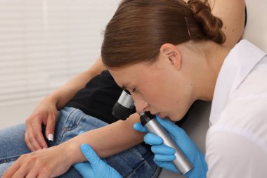 Doktor hastanede dermatoskopla genç kadının benini inceliyor.