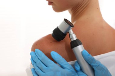 Doktor beyaz arka planda dermatoskopla genç kadının benini inceliyor.