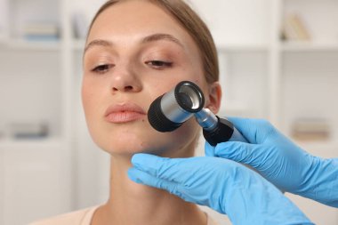 Doktor hastanede dermatoskopla genç kadının benini inceliyor.