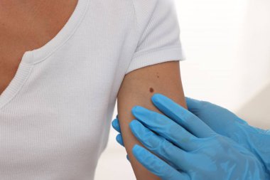 Doktor beyaz arka planda genç kadının benini inceliyor, yakın plan.