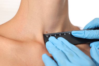 Doktor, beyaz arka planda cetvelle genç kadının benini inceliyor.