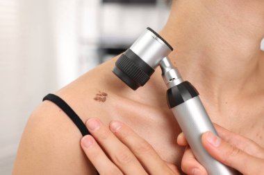 Doktor hastanede dermatoskopla genç kadının benini inceliyor.