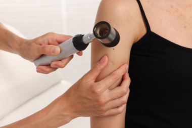 Doktor hastanede dermatoskopla genç kadının benini inceliyor.