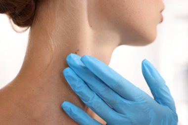 Doktor beyaz arka planda genç kadının benini inceliyor, yakın plan.