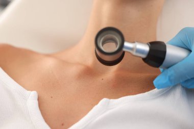 Doktor hastanede dermatoskopla genç kadının benini inceliyor.